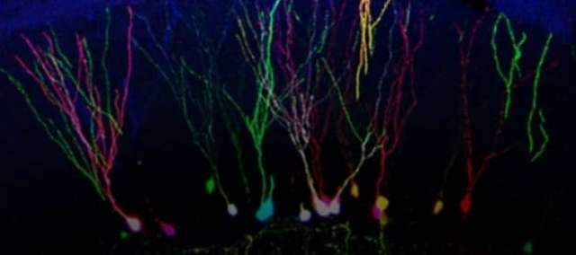 Hücre İşaretleme Tekniği İle Beynimizi Anlamak
