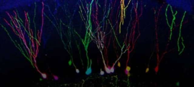 Hücre İşaretleme Tekniği İle Beynimizi Anlamak